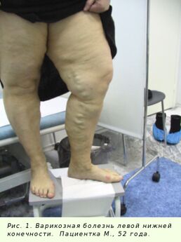 Spataderen moeten worden behandeld om het proces te stoppen